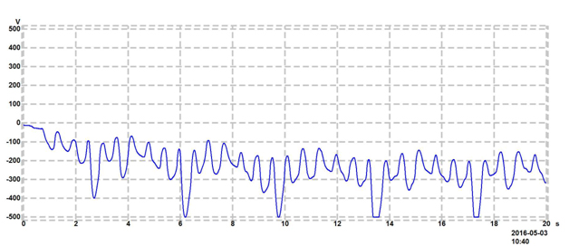 Figure Standard shoes, tile floor, with no wrist strap